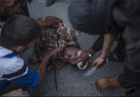 BU VƏHABİLƏR İNSAN DEYİLMİ? - FOTOFAKT