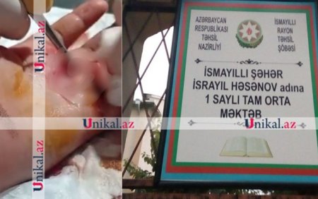 Şagird yoldaşını yaraladı, sinif rəhbəri hadisəni gizlətdi